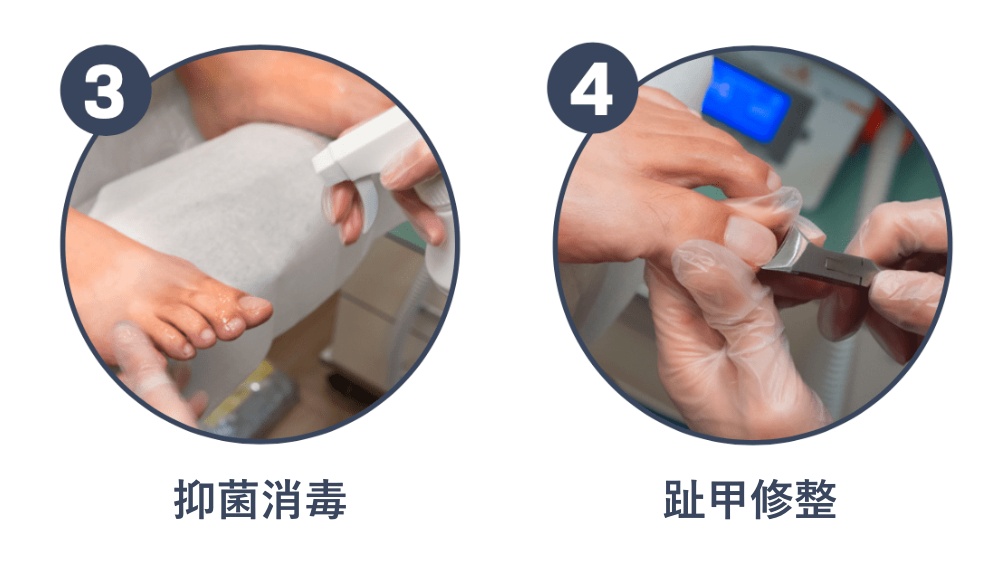服務流程三:抑菌消毒。服務流程四:趾甲修整