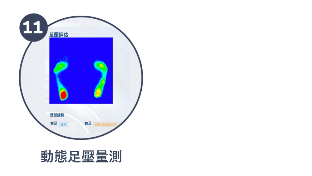 服務流程十一:動態足壓量測,了解自己是否有扁平足和拇趾外翻,扁平足和拇趾外翻容易導致嵌甲