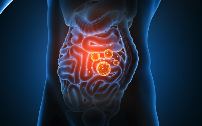 腸病毒、流感、新冠病毒齊發威！ 營養師推薦增強免疫力的5類保健品