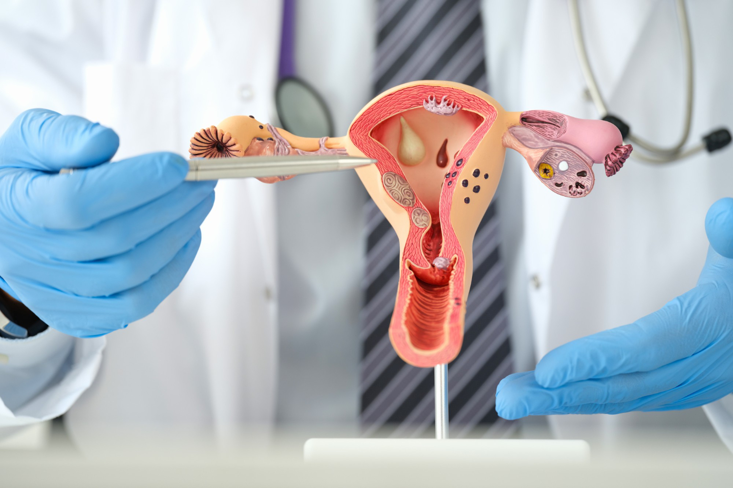 Man gynecologist showing female diseases with pen on plastic artificial model of uterus and ovaries