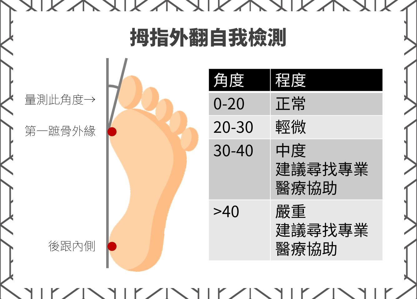 拇趾外翻自我檢測