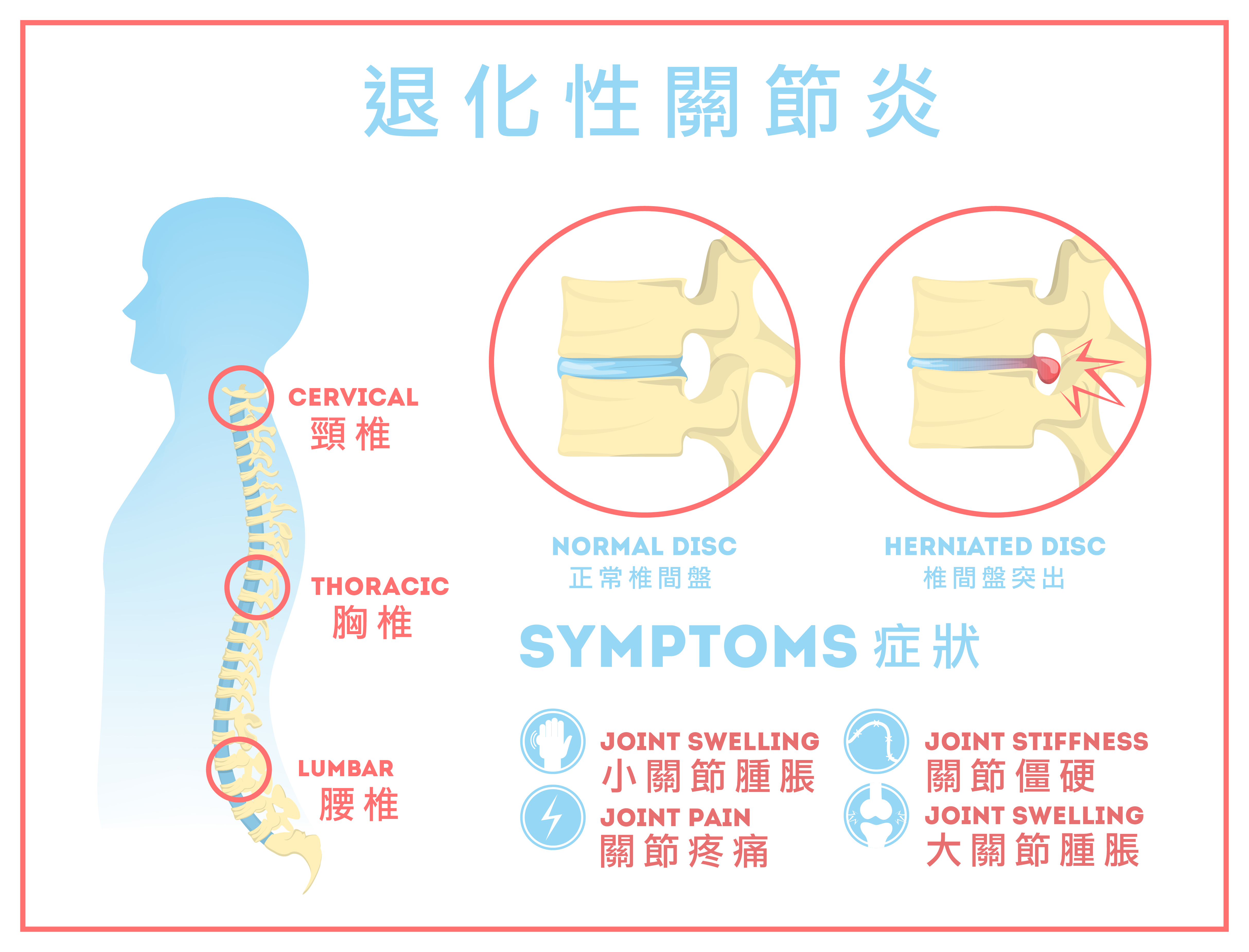 退化性關節炎的患者，因為關節處軟骨的退化、磨損，造成活動上容易疼痛、甚至關節變形，進而抗拒太大動作，更遑論運動。