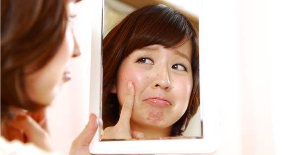 皮膚的煩惱 鏡中的自己