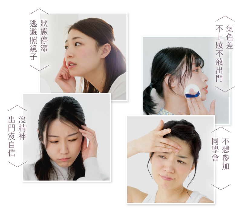 膠原蛋白流失會怎麼樣