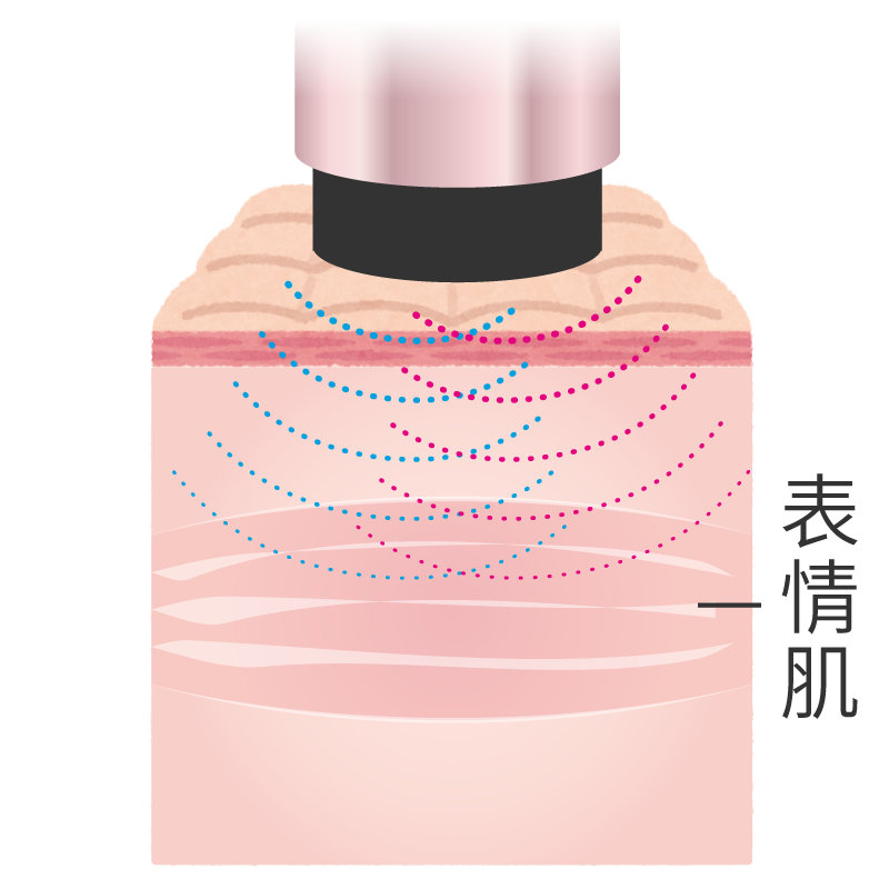 EMS微電流對表情肌的原理